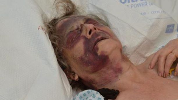 Iris Warner, a 90-year-old woman in the UK, was brutally assaulted in her sleep.