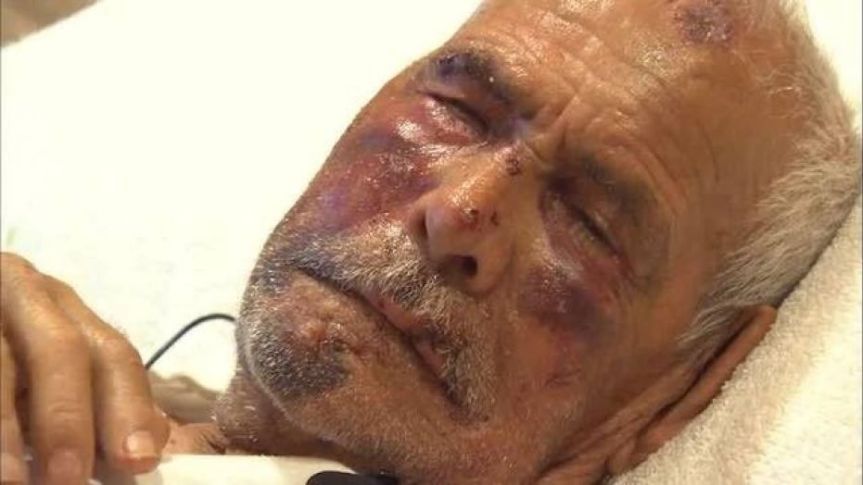Rodolfo Rodriguez, 92, was beaten