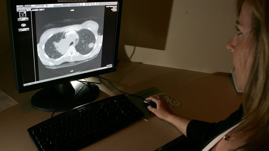 A radiology technologist looks at a CT scan