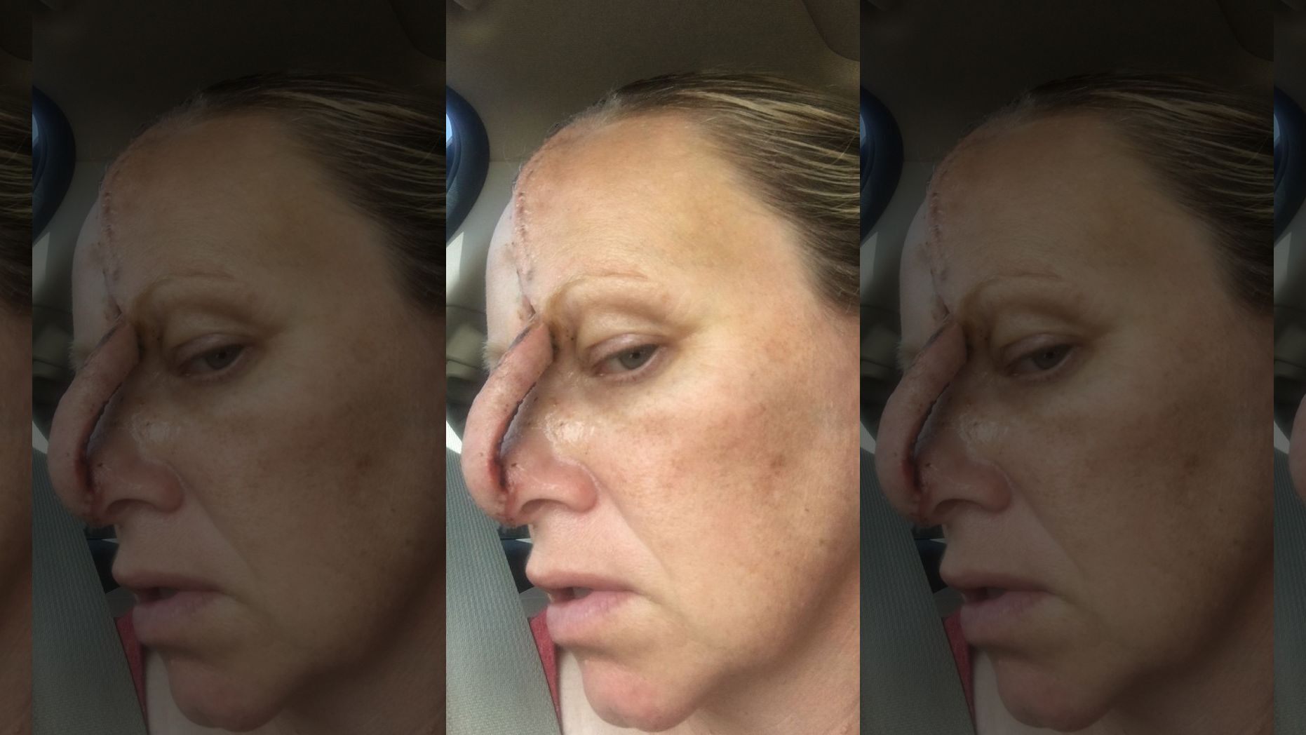 Her experience has moved her to warn others about the dangers of tanning, which is something she took for granted before her diagnosis. 