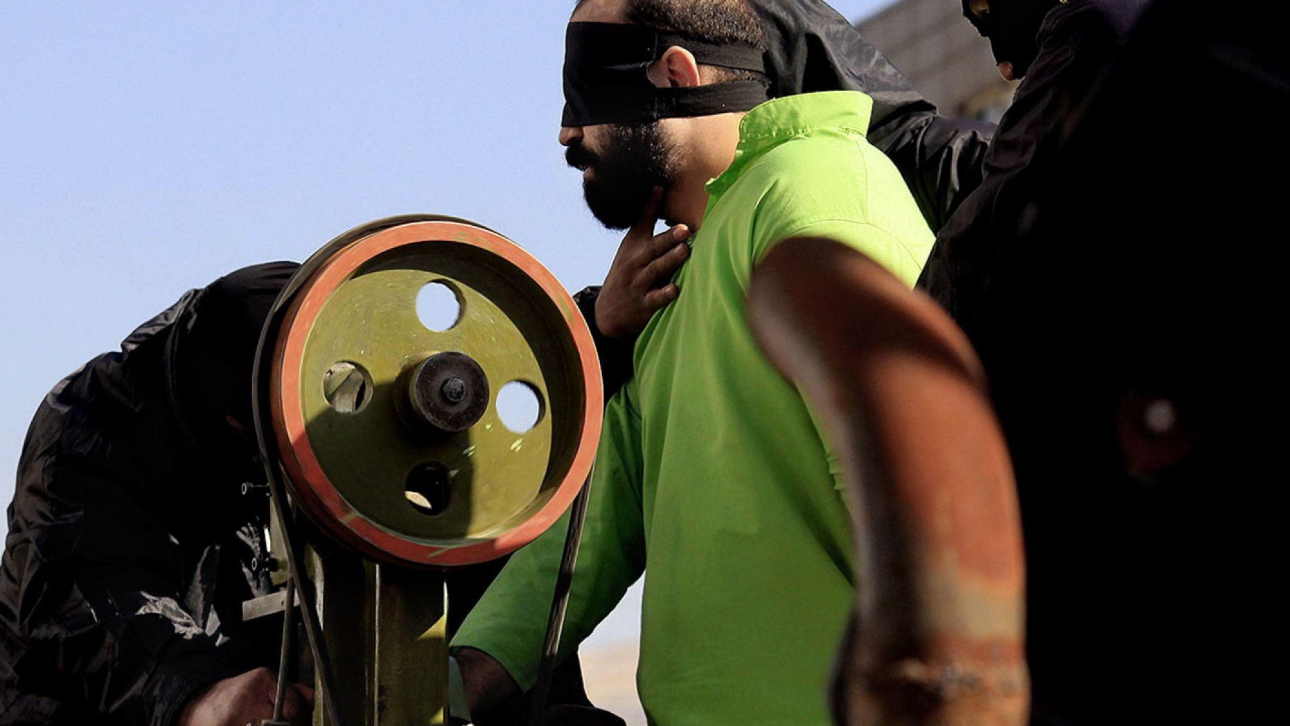 Authorities carry out the court-ordered amputation of the fingers of a convicted thief in a public square in the southern Iranian city of Shiraz in 2013.