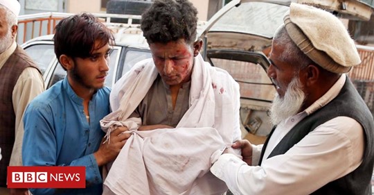 A boy receives medical treatment after a blast at a mosque in Nangarhar province