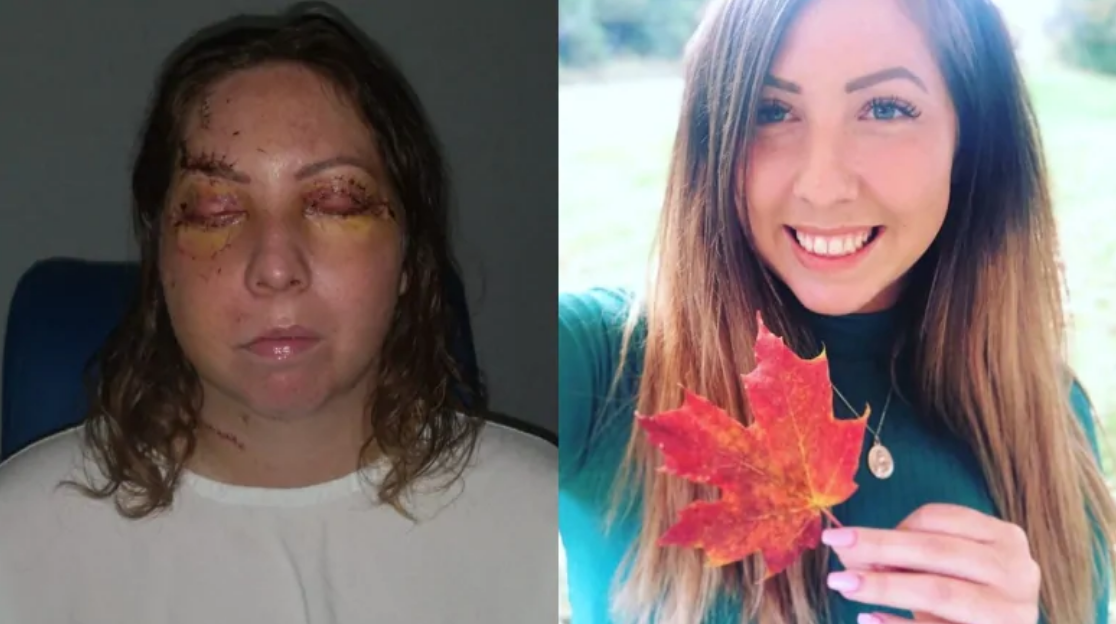 Lexie York was on vacation in Mexico's Yucatan Peninsula earlier this month when she was attacked in her hotel room, according to her family.