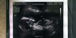 Susan Watts/NY Daily News Archive via Getty Images