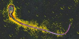 Photo By BSIP/UIG Via Getty Images