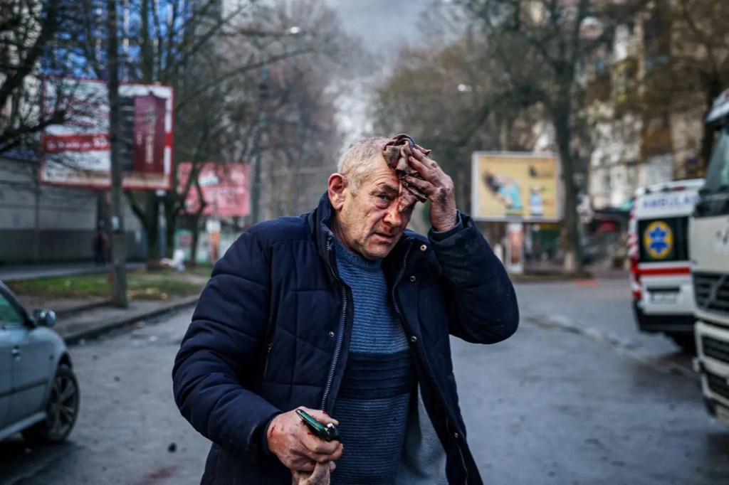 An injured man stands on a street after Russian shelling of the Ukrainian city of Kherson.
AFP via Getty Images